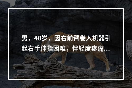 男，40岁，因右前臂卷入机器引起右手伸指困难，伴轻度疼痛。查