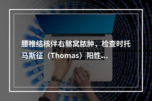 腰椎结核伴右髂窝脓肿，检查时托马斯征（Thomas）阳性，说