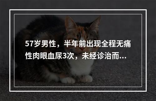 57岁男性，半年前出现全程无痛性肉眼血尿3次，未经诊治而自行