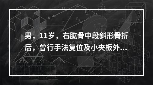 男，11岁，右肱骨中段斜形骨折后，曾行手法复位及小夹板外固定