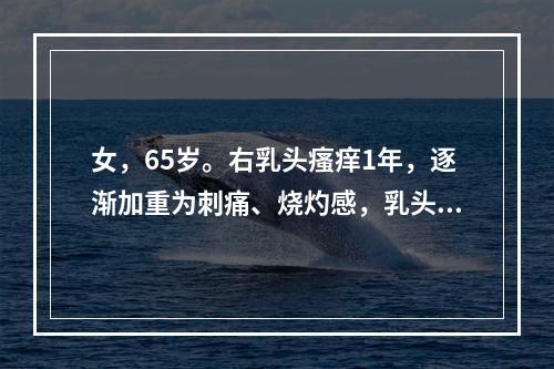 女，65岁。右乳头瘙痒1年，逐渐加重为刺痛、烧灼感，乳头有碎