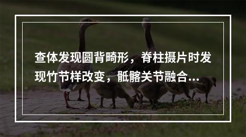 查体发现圆背畸形，脊柱摄片时发现竹节样改变，骶髂关节融合，应