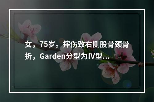 女，75岁。摔伤致右侧股骨颈骨折，Garden分型为Ⅳ型，下