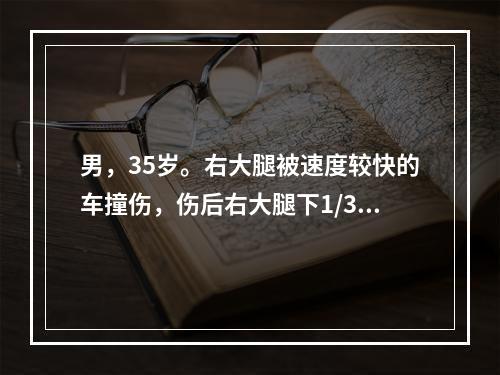 男，35岁。右大腿被速度较快的车撞伤，伤后右大腿下1/3向后