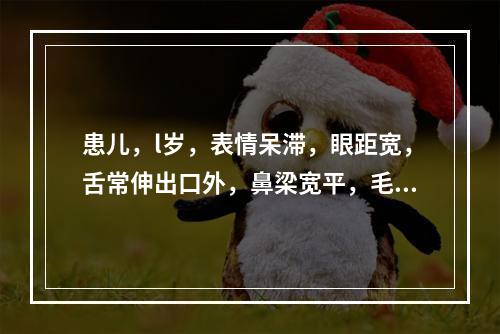 患儿，l岁，表情呆滞，眼距宽，舌常伸出口外，鼻梁宽平，毛发稀