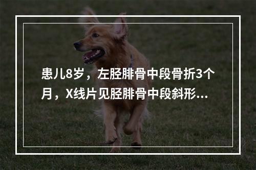 患儿8岁，左胫腓骨中段骨折3个月，X线片见胫腓骨中段斜形骨折