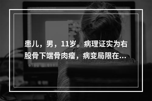 患儿，男，11岁。病理证实为右股骨下端骨肉瘤，病变局限在骨内