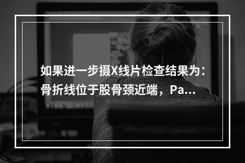 如果进一步摄X线片检查结果为：骨折线位于股骨颈近端，Pauw