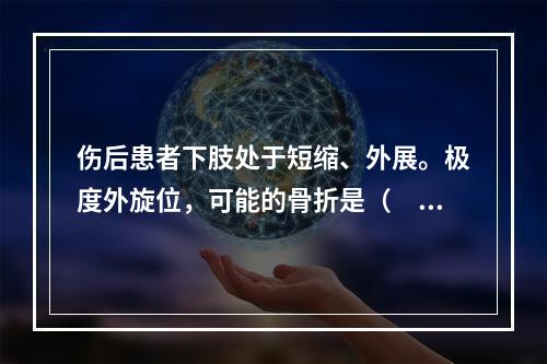 伤后患者下肢处于短缩、外展。极度外旋位，可能的骨折是（　　）