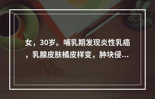 女，30岁。哺乳期发现炎性乳癌，乳腺皮肤橘皮样变，肿块侵及整