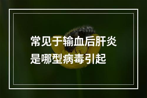 常见于输血后肝炎是哪型病毒引起