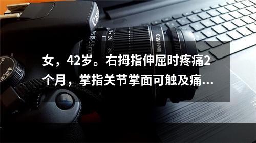 女，42岁。右拇指伸屈时疼痛2个月，掌指关节掌面可触及痛性结