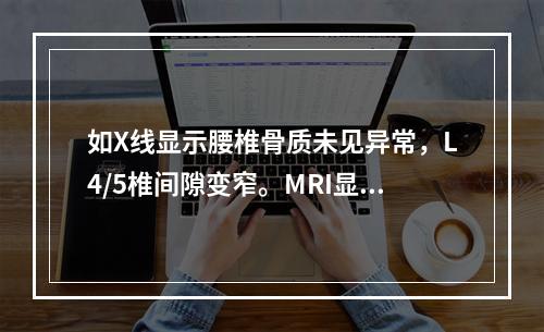 如X线显示腰椎骨质未见异常，L4/5椎间隙变窄。MRI显示腰