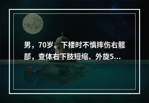 男，70岁。下楼时不慎摔伤右髋部，查体右下肢短缩、外旋50°
