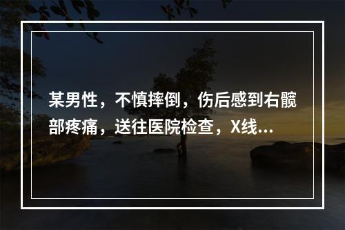 某男性，不慎摔倒，伤后感到右髋部疼痛，送往医院检查，X线片诊