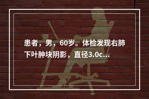 患者，男，60岁。体检发现右肺下叶肿块阴影，直径3.0cm，