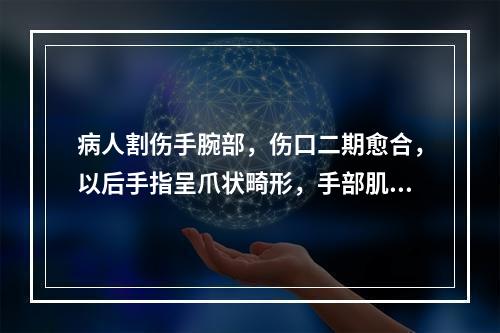 病人割伤手腕部，伤口二期愈合，以后手指呈爪状畸形，手部肌肉明