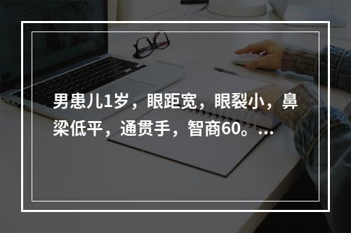 男患儿1岁，眼距宽，眼裂小，鼻梁低平，通贯手，智商60。确诊