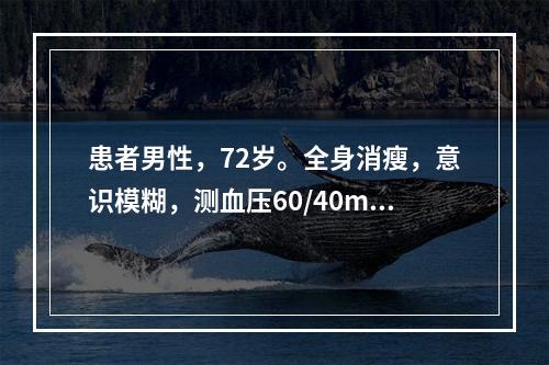 患者男性，72岁。全身消瘦，意识模糊，测血压60/40mmH