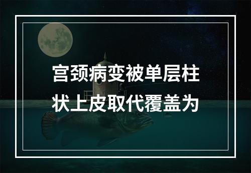 宫颈病变被单层柱状上皮取代覆盖为