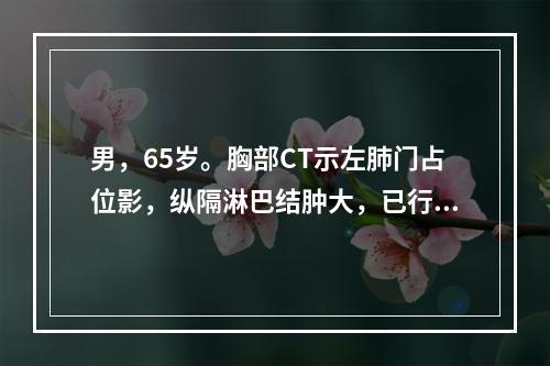 男，65岁。胸部CT示左肺门占位影，纵隔淋巴结肿大，已行左全