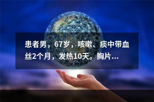 患者男，67岁，咳嗽、痰中带血丝2个月，发热10天。胸片显示