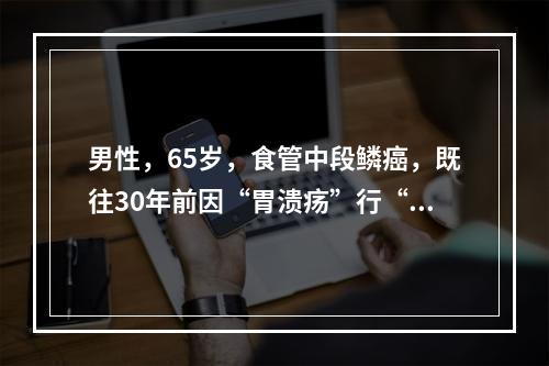 男性，65岁，食管中段鳞癌，既往30年前因“胃溃疡”行“胃大