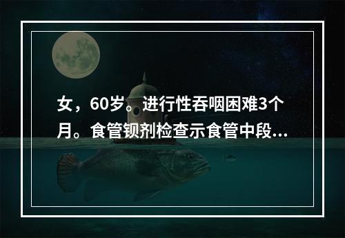 女，60岁。进行性吞咽困难3个月。食管钡剂检查示食管中段有4