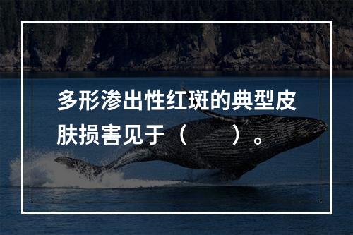 多形渗出性红斑的典型皮肤损害见于（　　）。