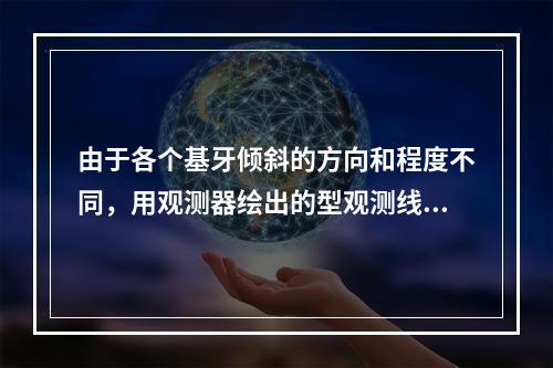 由于各个基牙倾斜的方向和程度不同，用观测器绘出的型观测线为（