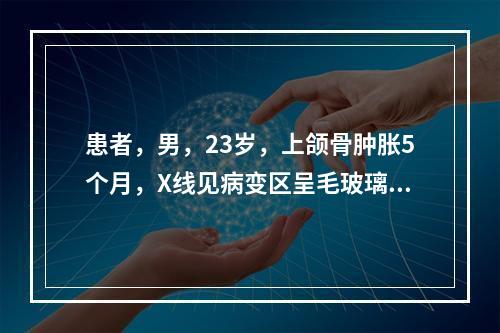 患者，男，23岁，上颌骨肿胀5个月，X线见病变区呈毛玻璃状，