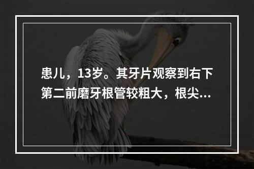 患儿，13岁。其牙片观察到右下第二前磨牙根管较粗大，根尖处有