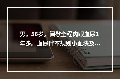 男，56岁。间歇全程肉眼血尿1年多。血尿伴不规则小血块及轻度