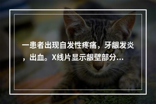 一患者出现自发性疼痛，牙龈发炎，出血。X线片显示龈壁部分充填