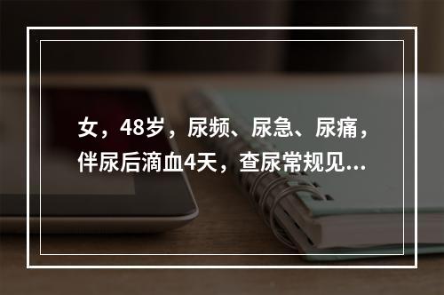 女，48岁，尿频、尿急、尿痛，伴尿后滴血4天，查尿常规见许多