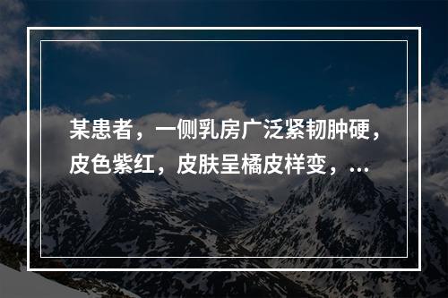 某患者，一侧乳房广泛紧韧肿硬，皮色紫红，皮肤呈橘皮样变，全身