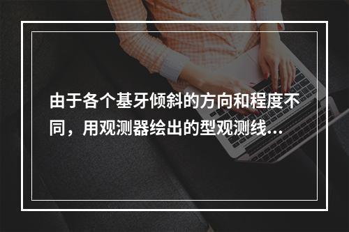 由于各个基牙倾斜的方向和程度不同，用观测器绘出的型观测线为（