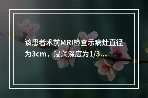 该患者术前MRI检查示病灶直径为3cm，浸润深度为1/3肌层