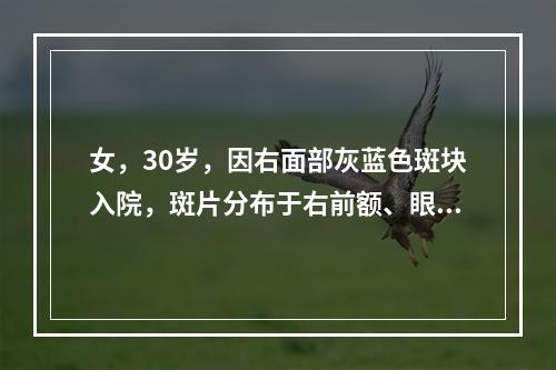 女，30岁，因右面部灰蓝色斑块入院，斑片分布于右前额、眼周、