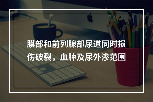 膜部和前列腺部尿道同时损伤破裂，血肿及尿外渗范围