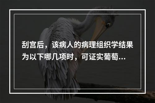 刮宫后，该病人的病理组织学结果为以下哪几项时，可证实葡萄胎诊