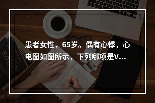 患者女性，65岁。偶有心悸，心电图如图所示，下列哪项是V4