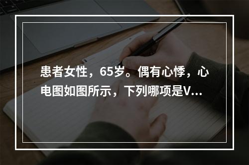 患者女性，65岁。偶有心悸，心电图如图所示，下列哪项是V4