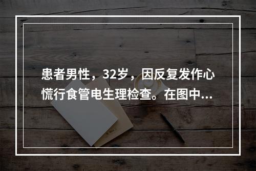 患者男性，32岁，因反复发作心慌行食管电生理检查。在图中采