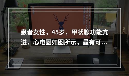 患者女性，45岁，甲状腺功能亢进，心电图如图所示，最有可能