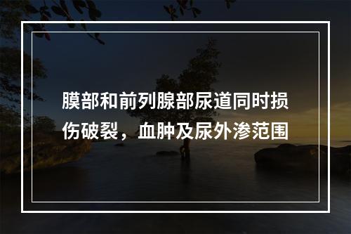 膜部和前列腺部尿道同时损伤破裂，血肿及尿外渗范围