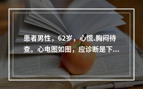 患者男性，62岁，心慌.胸闷待查。心电图如图，应诊断是下列