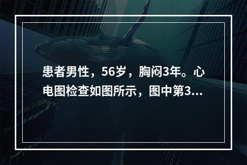 患者男性，56岁，胸闷3年。心电图检查如图所示，图中第3.