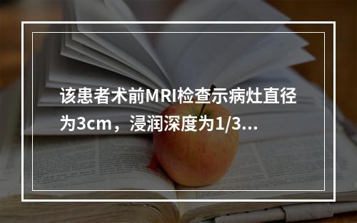 该患者术前MRI检查示病灶直径为3cm，浸润深度为1/3肌层