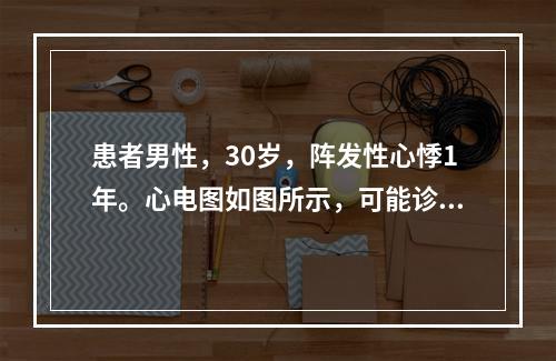 患者男性，30岁，阵发性心悸1年。心电图如图所示，可能诊断